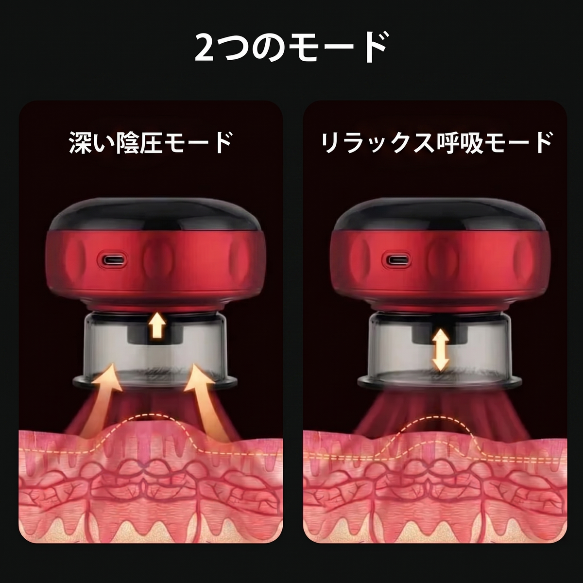 カタチ™カッピングセラピー